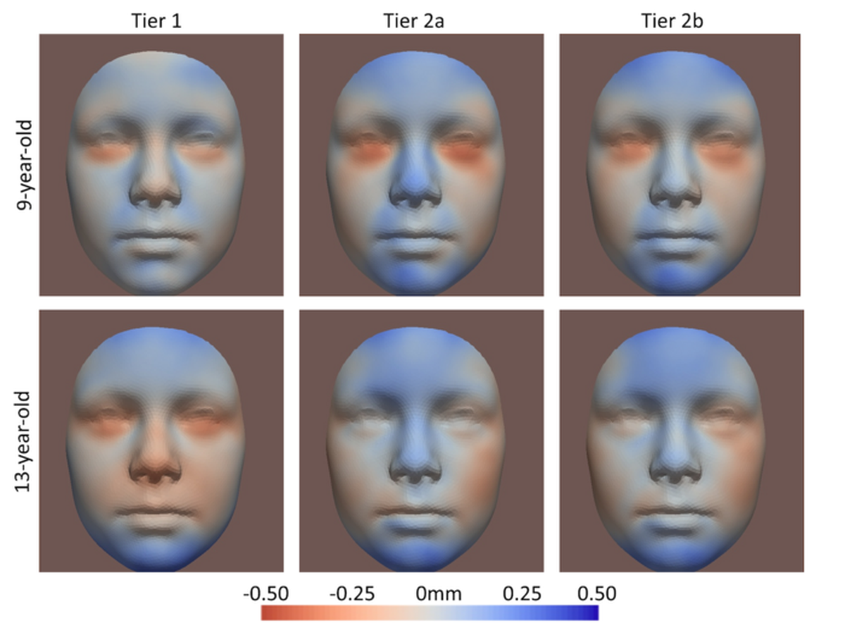 Facial features like nose and chin shape may be determined by alcohol consumption of the mother during pregnancy.