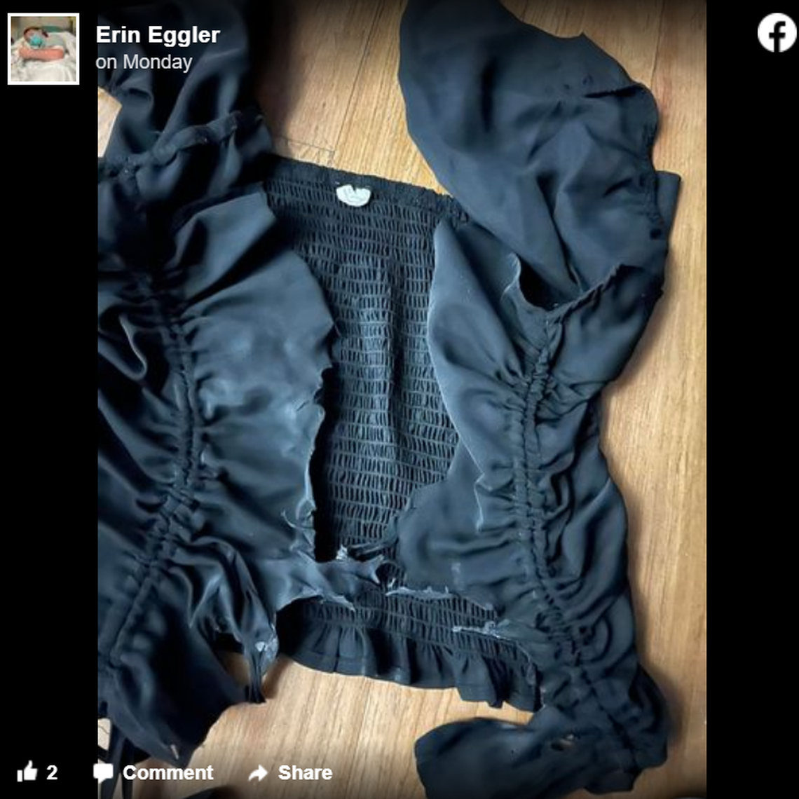 Emma Eggler’s shirt melted into her body after her chest was hit with lightning.