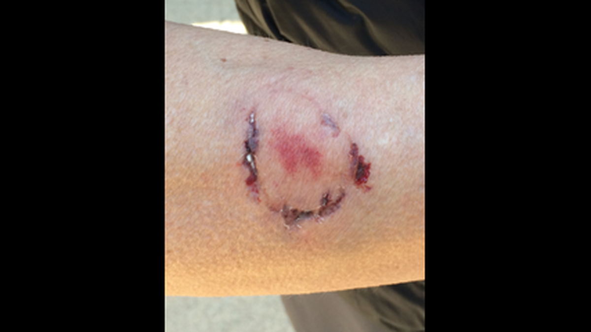 Police said the dog owner left “significant wounds” on the jogger’s forearm, which clearly were not bite marks left by a dog.