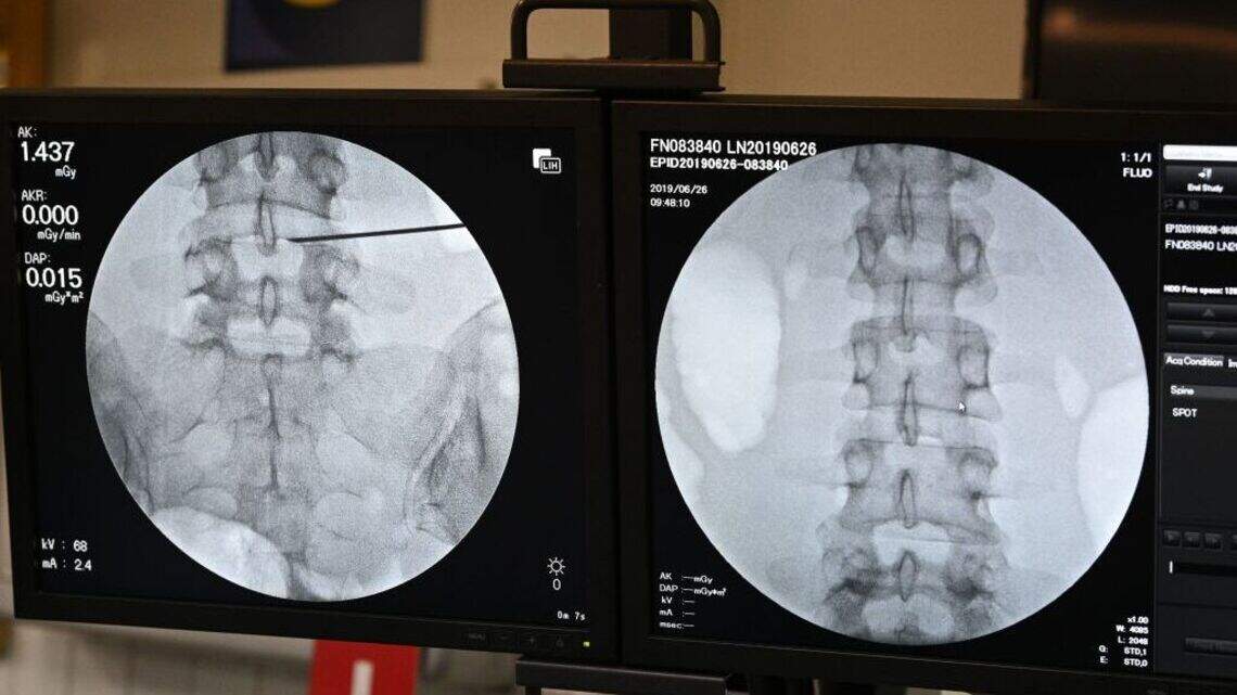 Study finds new lymphatic networks in the spine, signaling a deeper connection to whole-body health