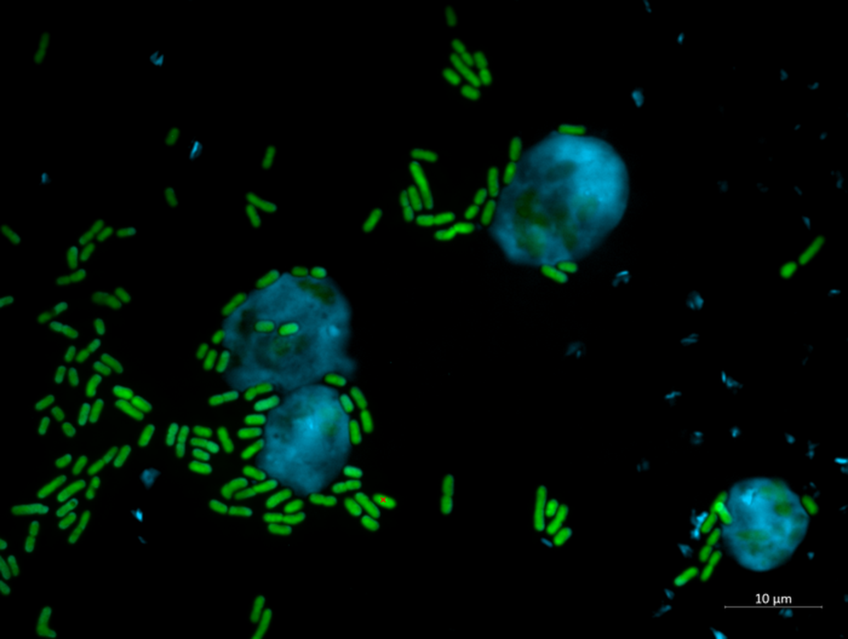 Scientists proved that Keanumycin is effective against both plant fungal diseases and human-pathogenic fungi.
