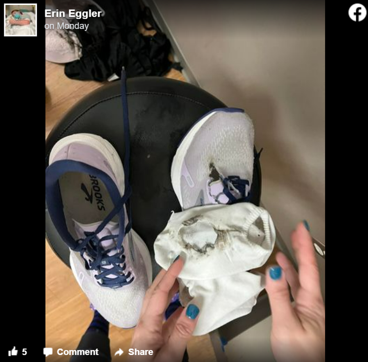 Lightning traveled through Emma Eggler’s body before exiting through her foot and burning a hole through her sock and sneaker.