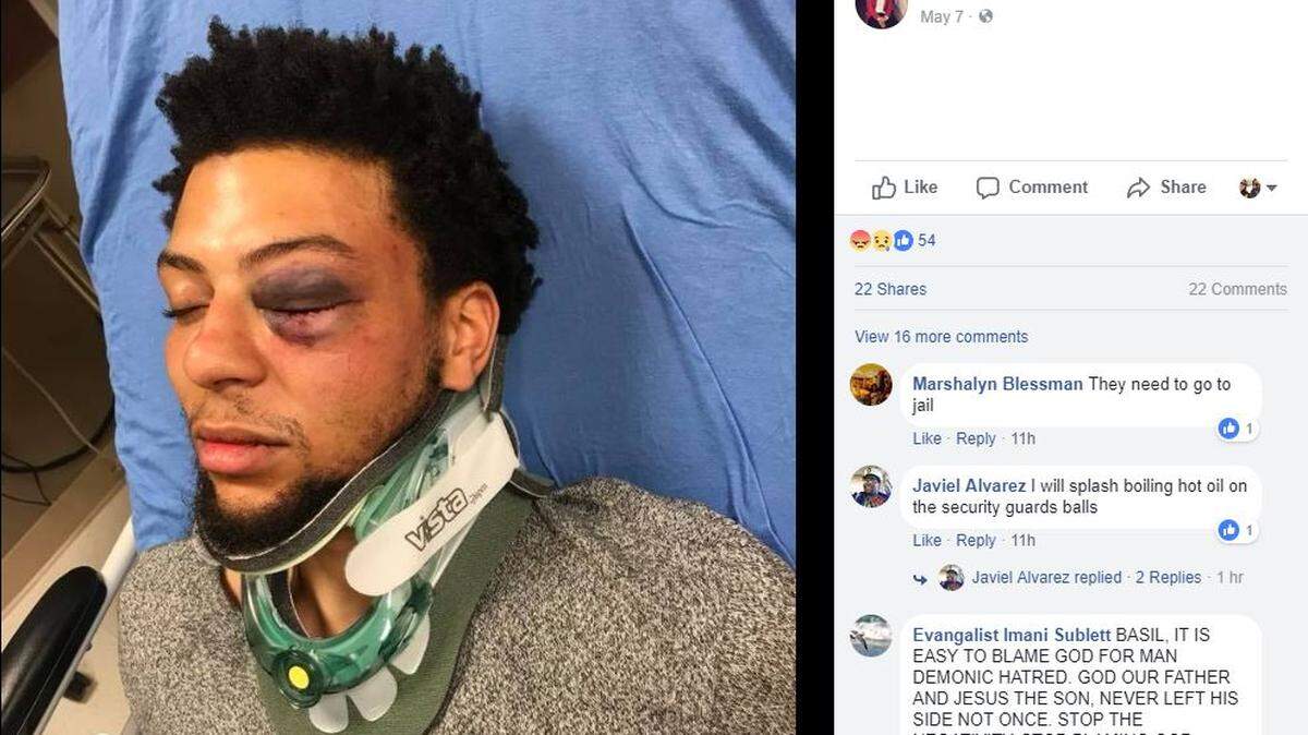 Jalen Bell says he was beaten by a group of racist white security guards at Dallas' XTC Cabaret Sunday morning.