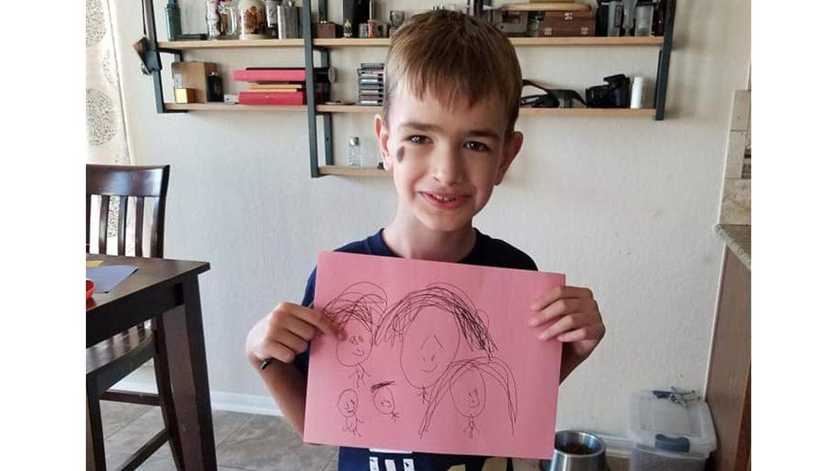 Mason Motz, now 6, didn’t speak for the first five years of his life. His dentist finally figured out why.