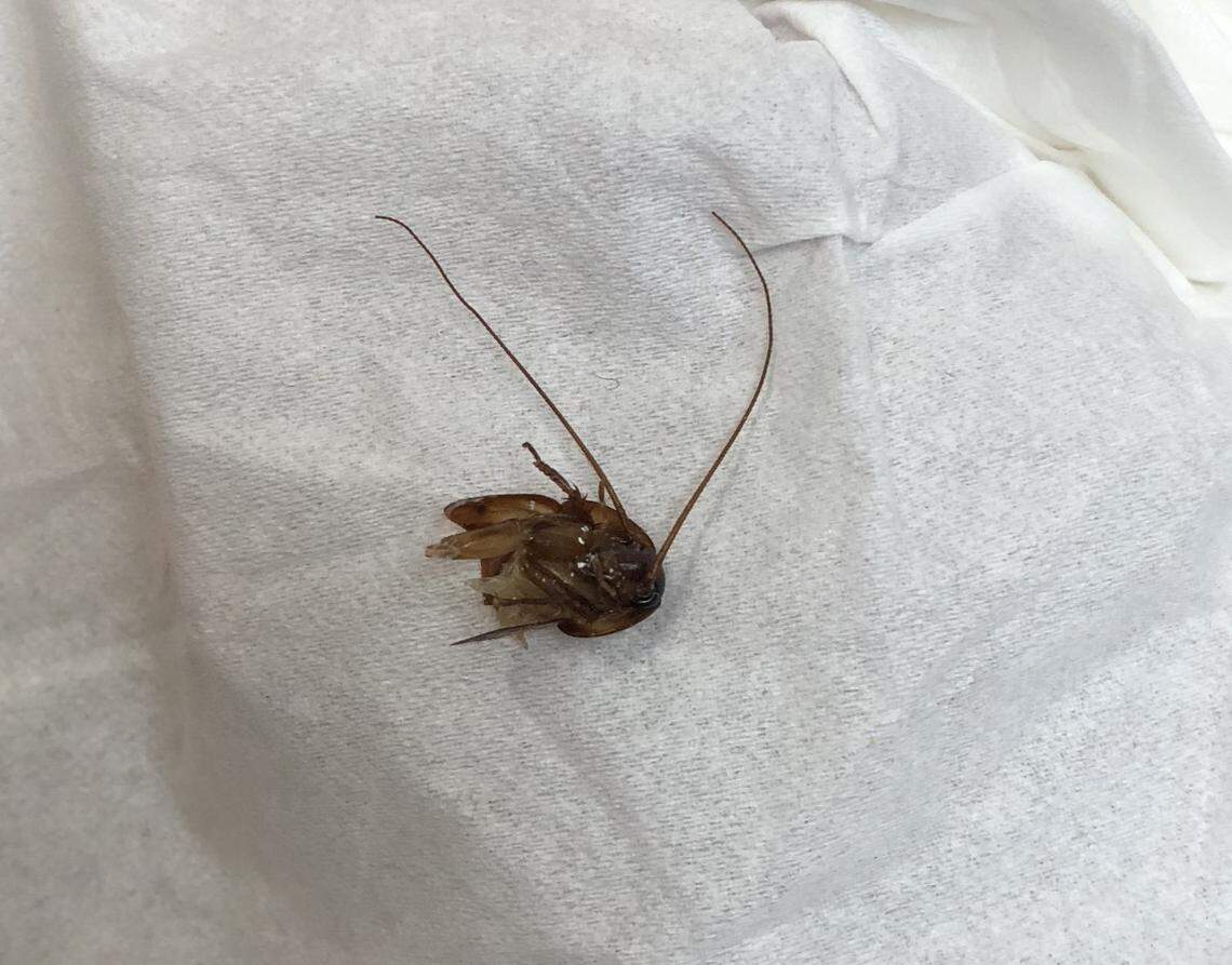 The last section of the roach that an ear, nose and throat specialist extracted from Katie Holley's right ear, nine days after she awoke in horror with the bug burrowing into her head.