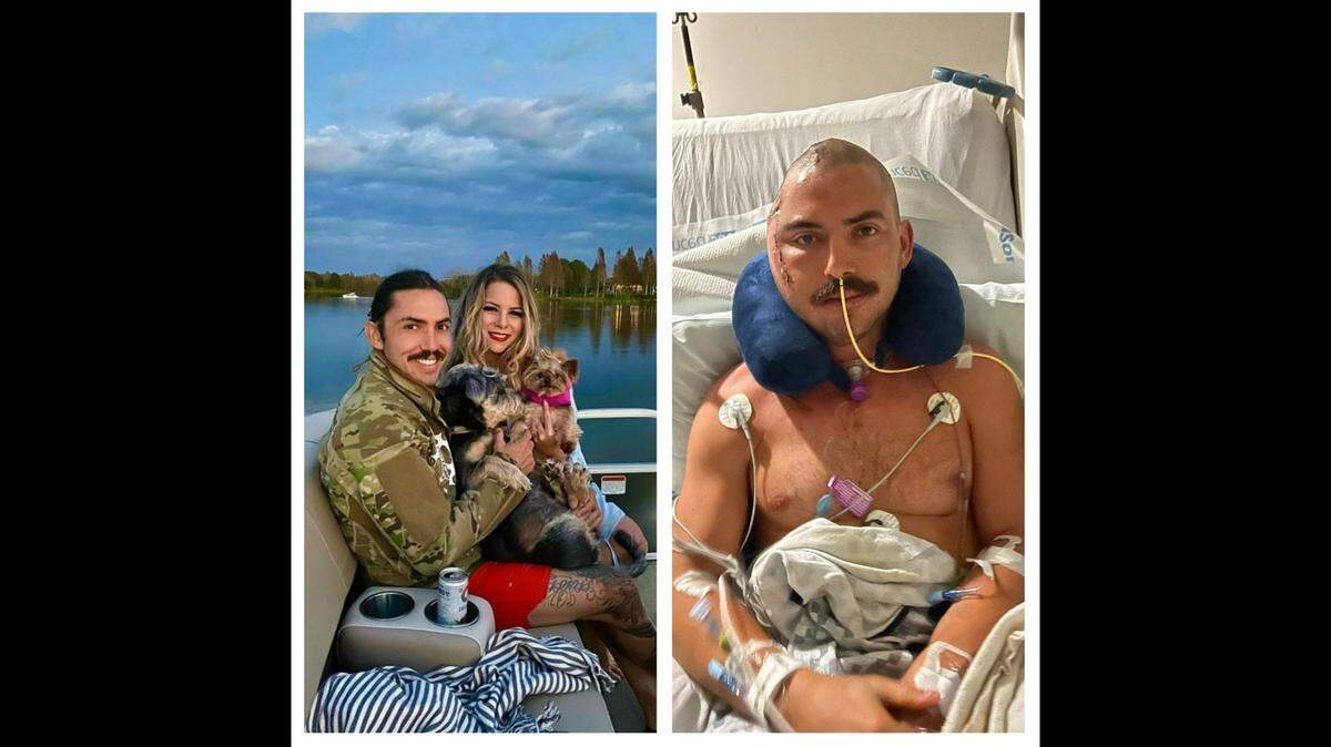 Juan Carlos La Verde, de 34 años, conocido como JC Derrota, enfrenta meses de recuperación después de sobrevivir al ataque de un caimán en un lago de Florida.