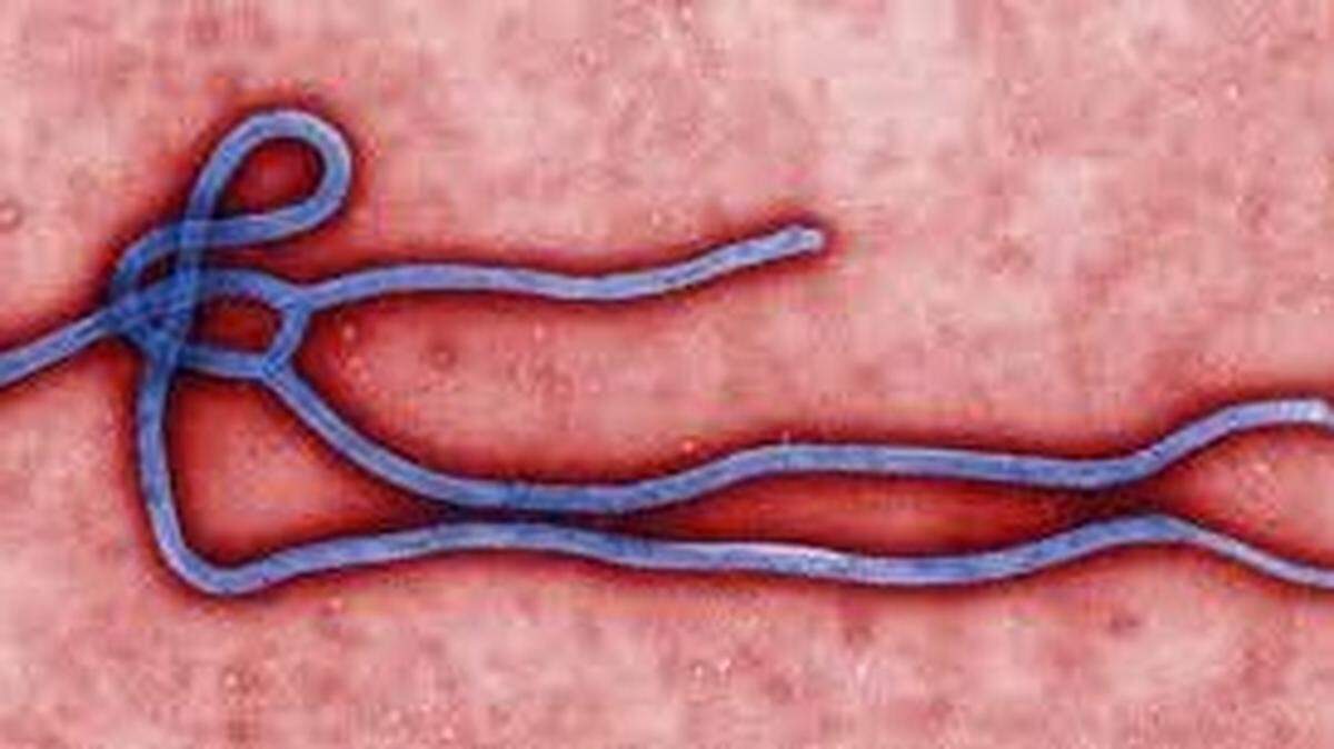 Health officials in Washington are monitoring 23 people for Ebola after they traveled to West African countries experiencing outbreaks.