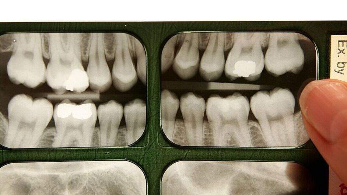 Wisdom teeth found to hold two secret abilities, driving regenerative medicine research forward