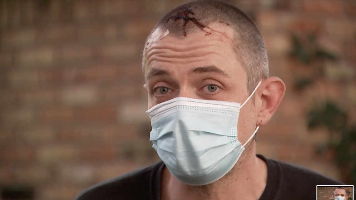 Houston bar doorman Josh Vaughan told TV station KTRK the maskless customer “got me good.” Vaughan required 10 stitches after being hit on the head with a glass.