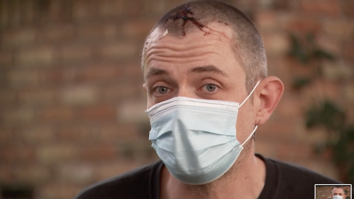 Houston bar doorman Josh Vaughan told TV station KTRK the maskless customer “got me good.” Vaughan required 10 stitches after being hit on the head with a glass.