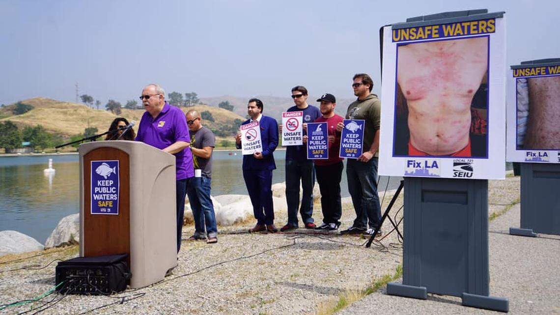 Lifeguards and a Los Angeles union have filed a grievance accusing the city of forcing lifeguard into “dangerous and unsafe” Hansen Dam Recreational Lake water despite warnings, resulting in dozenz getting swimmers’ itch rashes and bacterial infections.