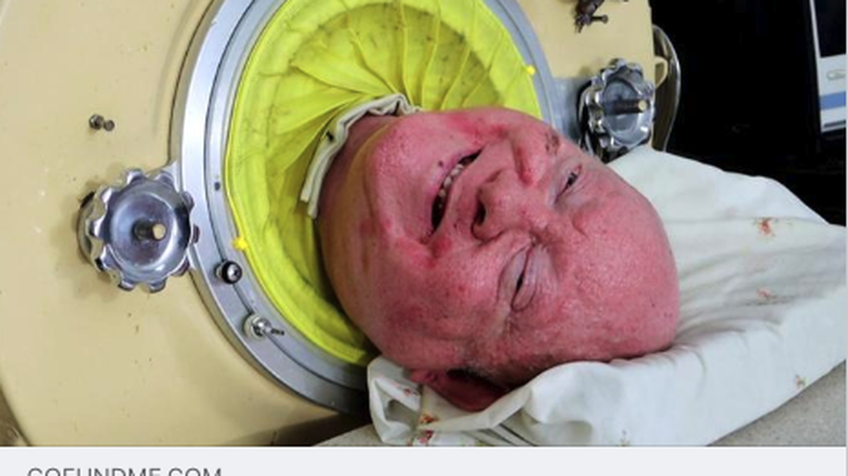 Paul Alexander lived in an iron lung for more than seven decades.