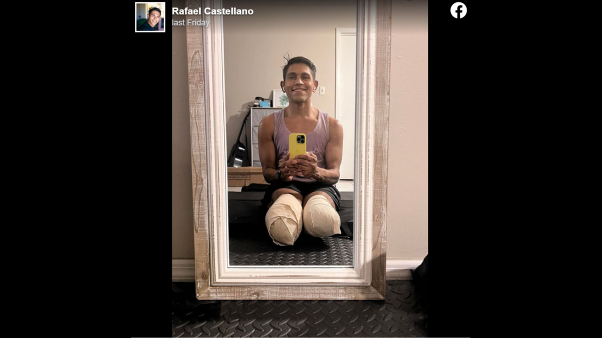 Rafael Castellano, a professional dancer from Orlando, Florida, lost both of his legs after a three-month bout with meningitis, but he hasn’t given up hope that he will one day “dance again.”