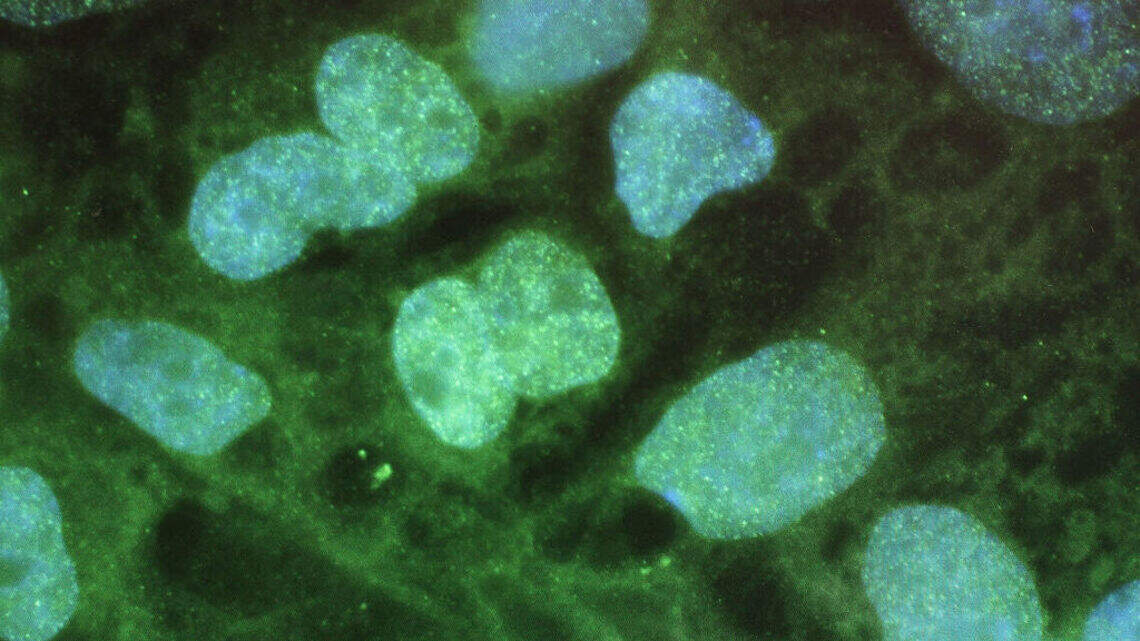 New research links semaglutide to improved lymphatic function: Why lymph matters more than you think