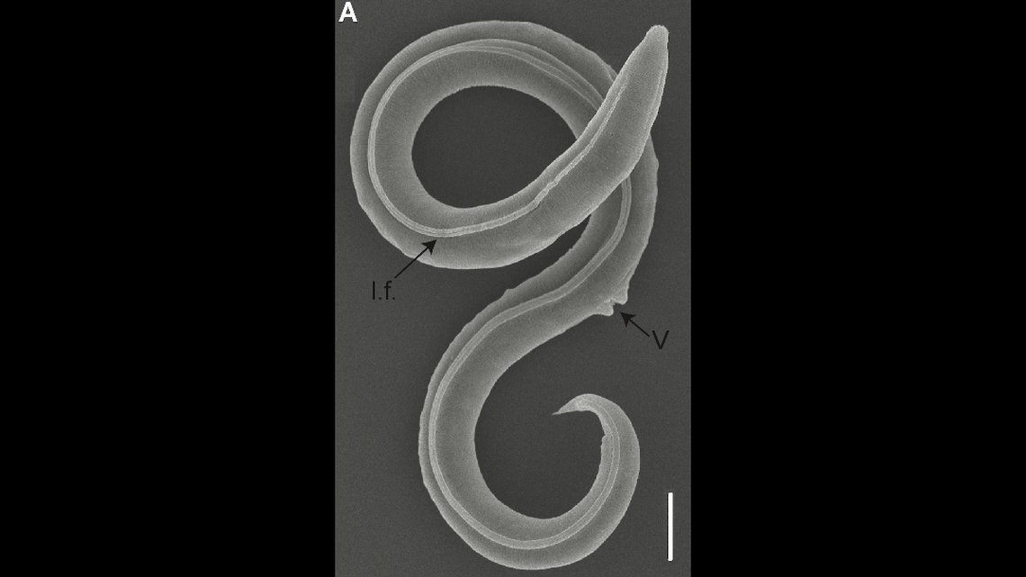 Researchers revived 46,000-year-old worms found in the Siberian permafrost, according to a new study.