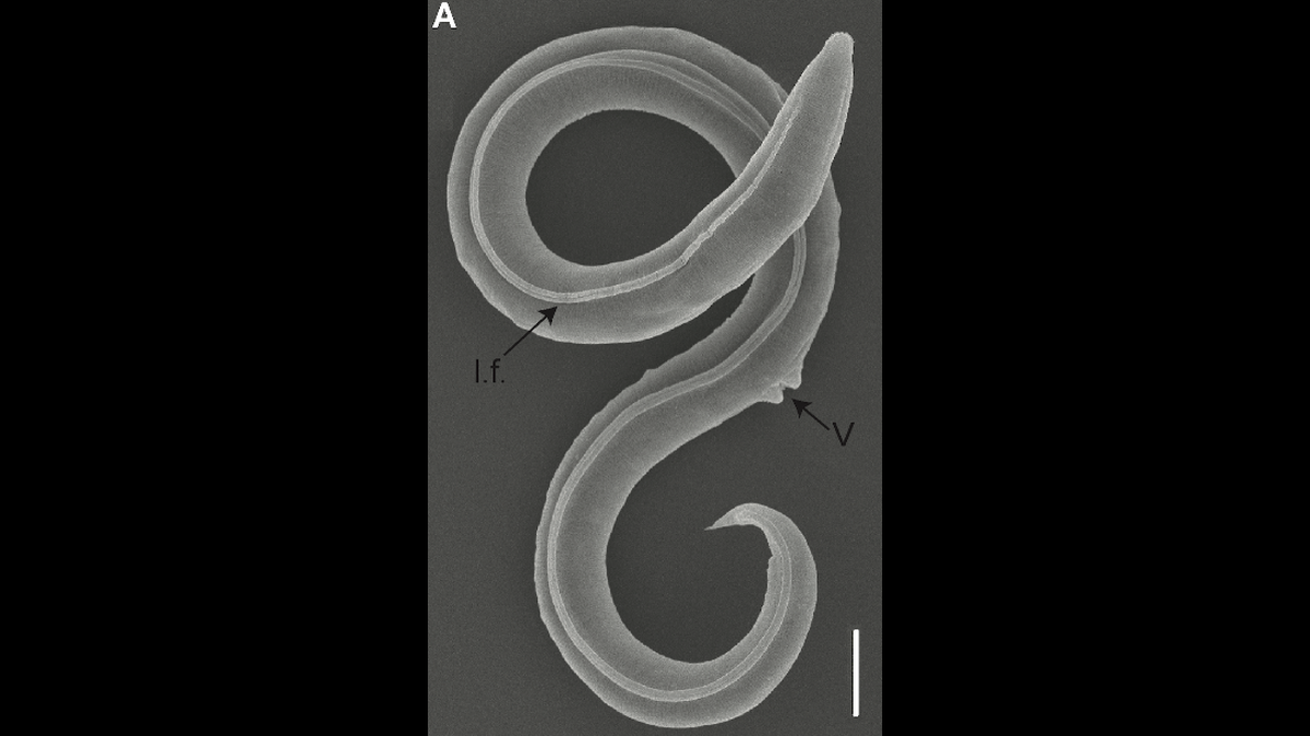 Researchers revived 46,000-year-old worms found in the Siberian permafrost, according to a new study.