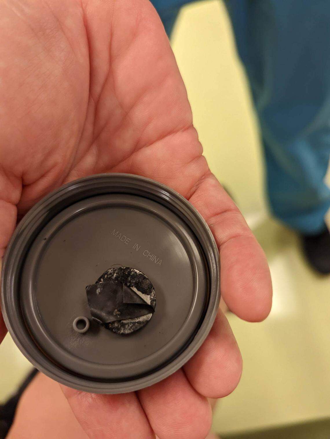 The battery found in Luke’s esophagus was wrapped in electrical tape, likely saving his life.