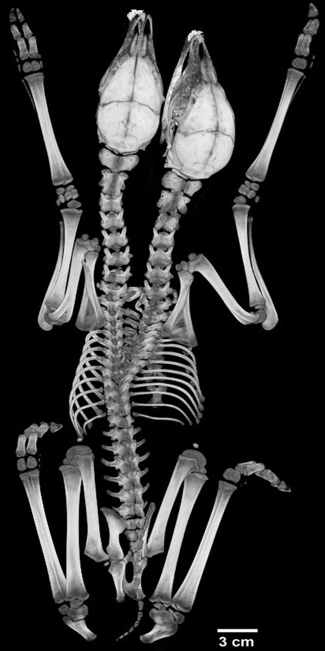 Separate heads and necks are visible in a CT scan of the conjoined fawns.