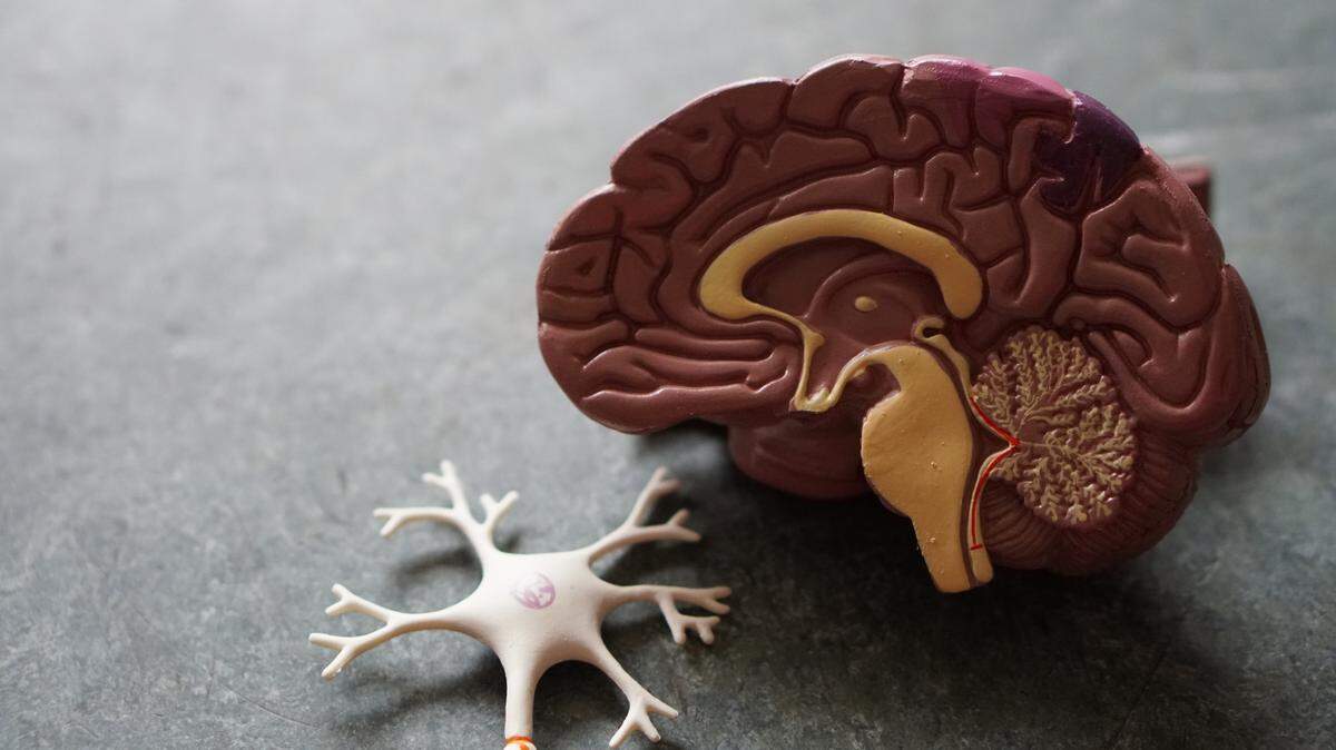 Monster under the bed? Bad dreams as a child might hurt your brain health later in life, researchers say.