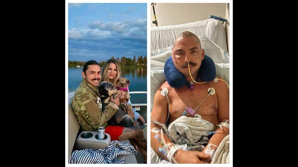 Man survives alligator attack in Florida lake | Kansas City Star