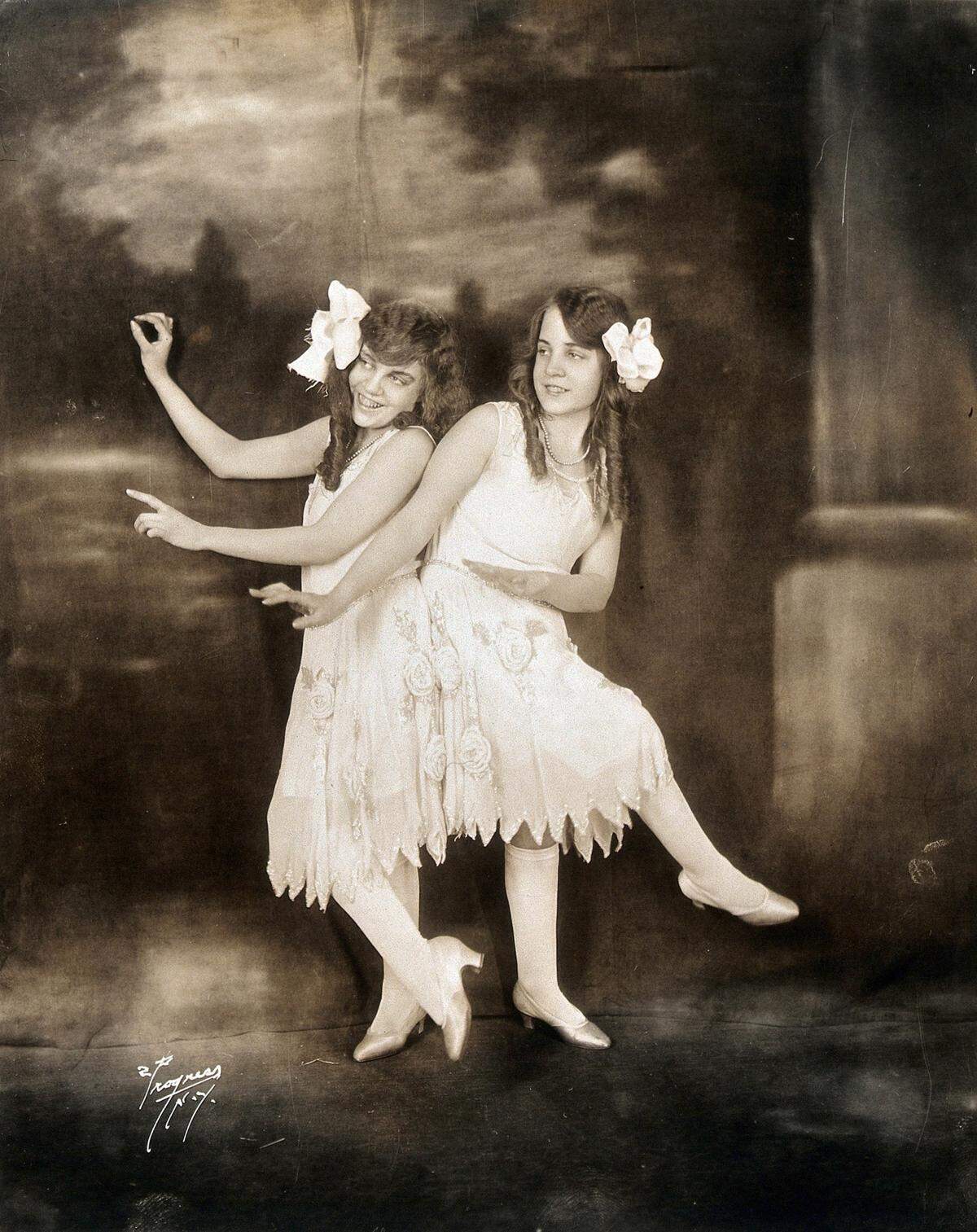Daisy and Violet Hilton were taught to play instruments and forced onto the carnival sideshow circuit by their adoptive mother, Mary Hilton.