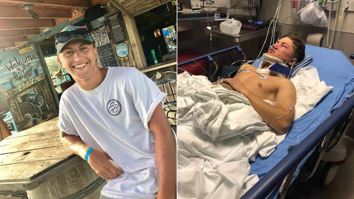 Triston Bailey, 18, survived a 50-foot fall from Margaret McDermott Bridge in Dallas in Nov. 2018.