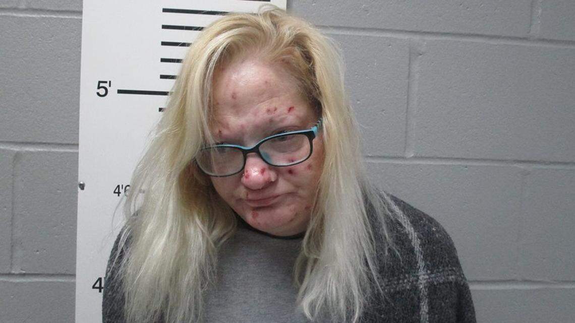 Carol Ballweg was charged Wednesday with two counts of abusing a vulnerable person and four counts of stealing a controlled substance, according to police in Troy, Missouri. Her bond was set at $100,000 cash.
