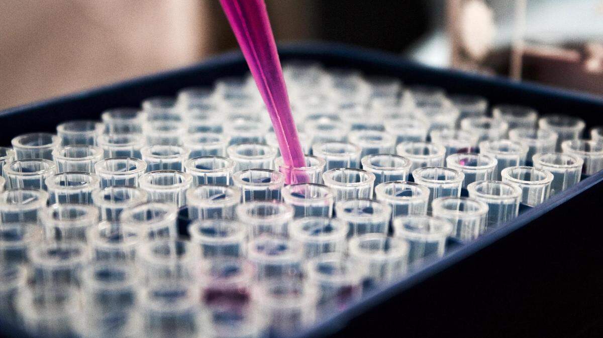 Researchers have developed a diagnostic test that can predict future autism in infants, according to a new study.