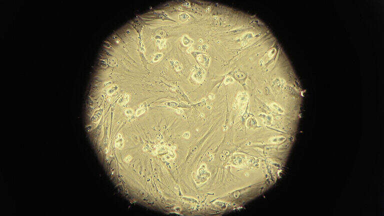 Your body has a hidden immune system with no pump, and doctors say you might be slowing it down