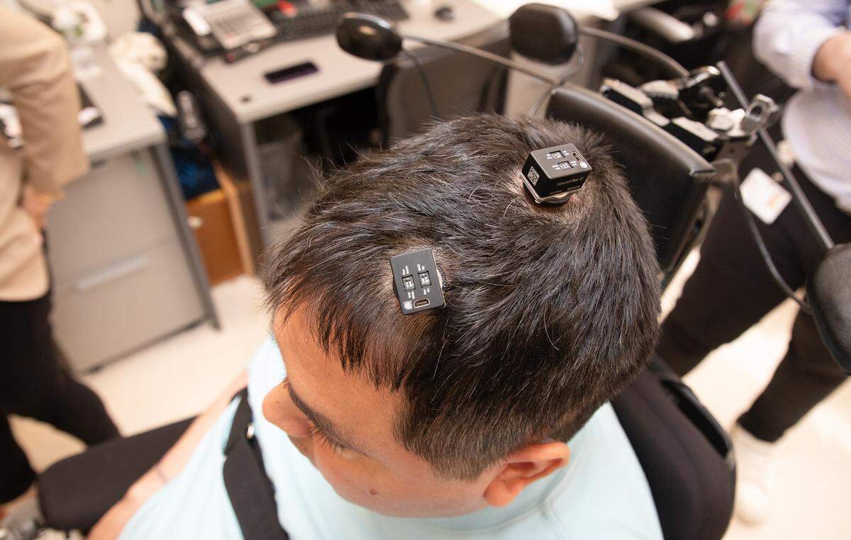 The implants in Thomas’ head read when he thinks about moving his arm and send the thought to a computer that uses AI to translate it into an action.