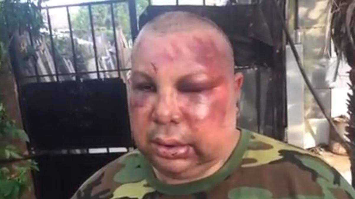 Jorge Gomez, 39, says the two off-duty New Orleans police officers asked him if he was American before beating him at a local bar.