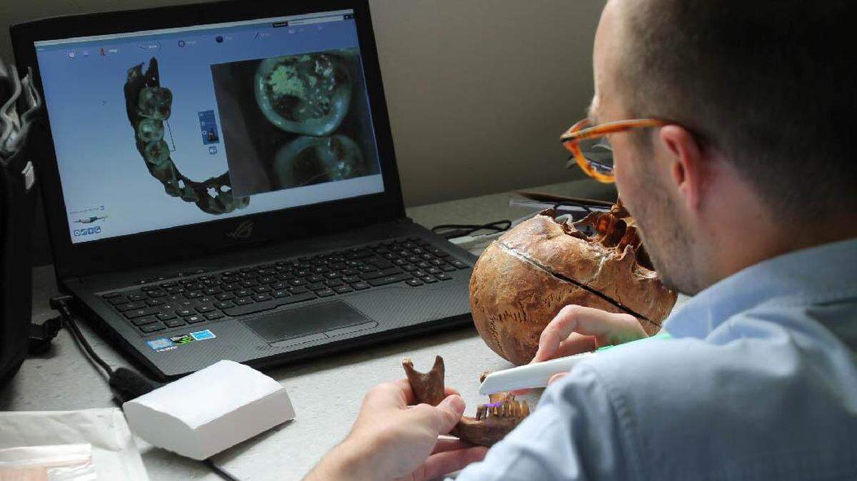 Researchers studied the remains of Anne D’Alègre, a French aristrocrat, to learn the secret to her golden smile.