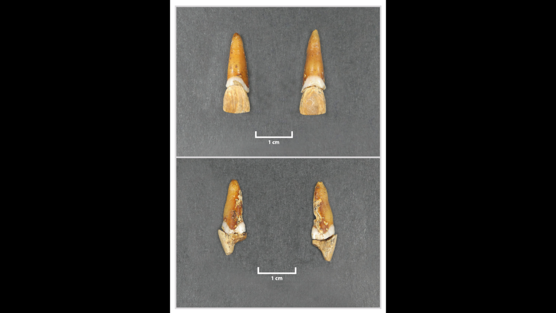 The two prosthetic teeth were identical and likely served both aesthetic and practical purposes.