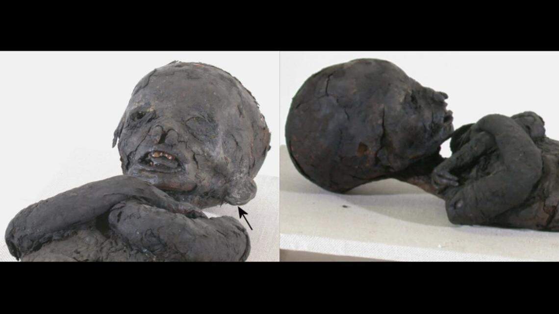 CT scans of ancient child mummies revealed they suffered from an illness that gave them enlarged skulls, according to a new study.