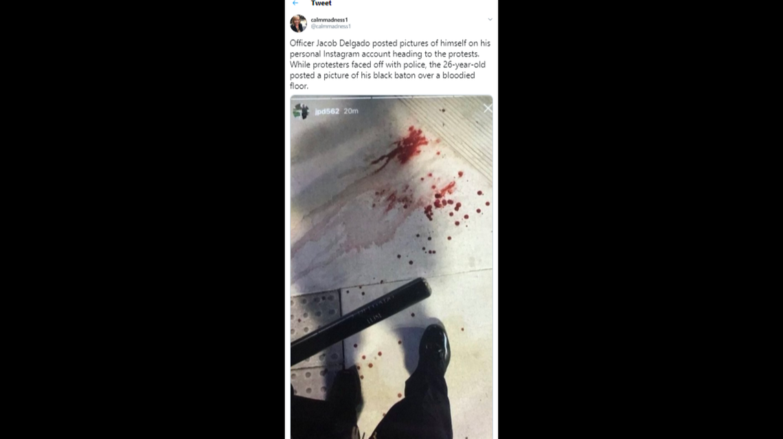 A Long Beach Police officer posted a photo of himself holding a baton over a blood-spattered sidewalk during George Floyd protests in the city. The police department has “relieved” him of employment.