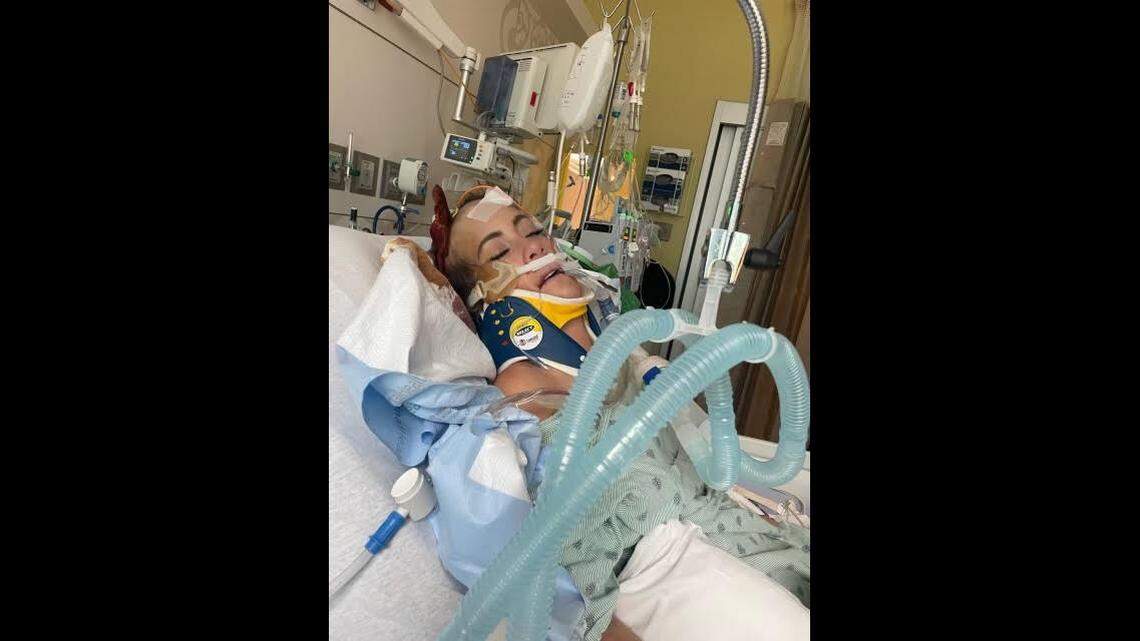 Katherine Elkins suffered a traumatic brain injury, broken bones and other injuries, her sister said. The family created a GoFundMe page to help support her through her recovery.