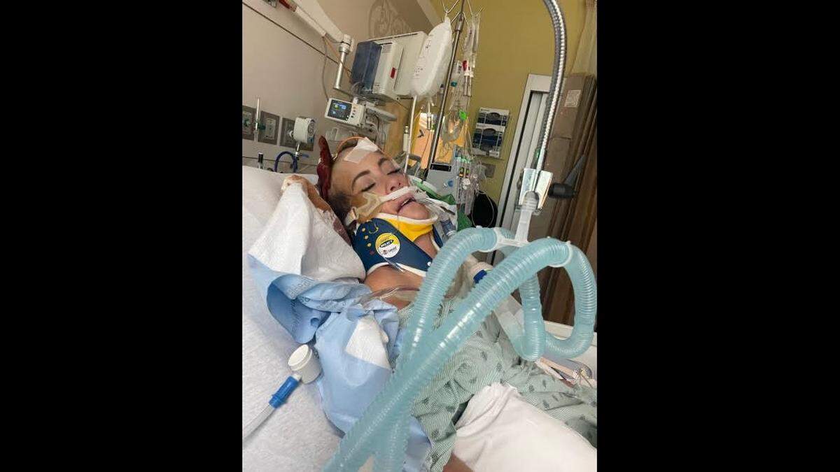 Katherine Elkins suffered a traumatic brain injury, broken bones and other injuries, her sister said. The family created a GoFundMe page to help support her through her recovery.