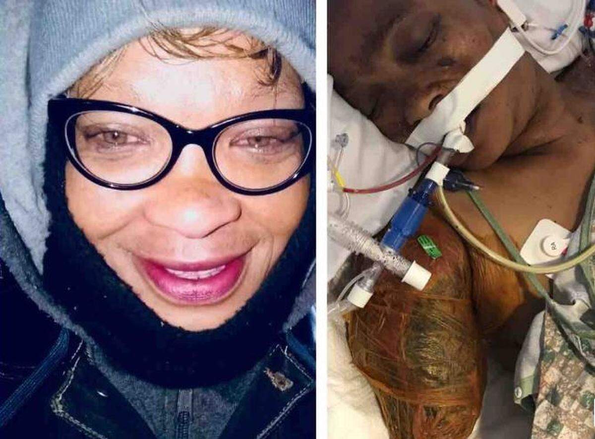 Terri Cosby, 54, is in intensive care in Oklahoma after four pit bulls mauled her.