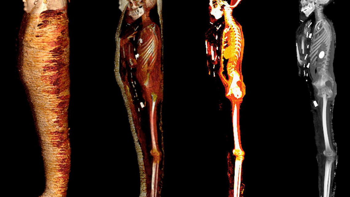 A mummy that sat in storage for over 100 years was finally examined, researchers in Cairo said. Scans revealed dozens of golden treasures.