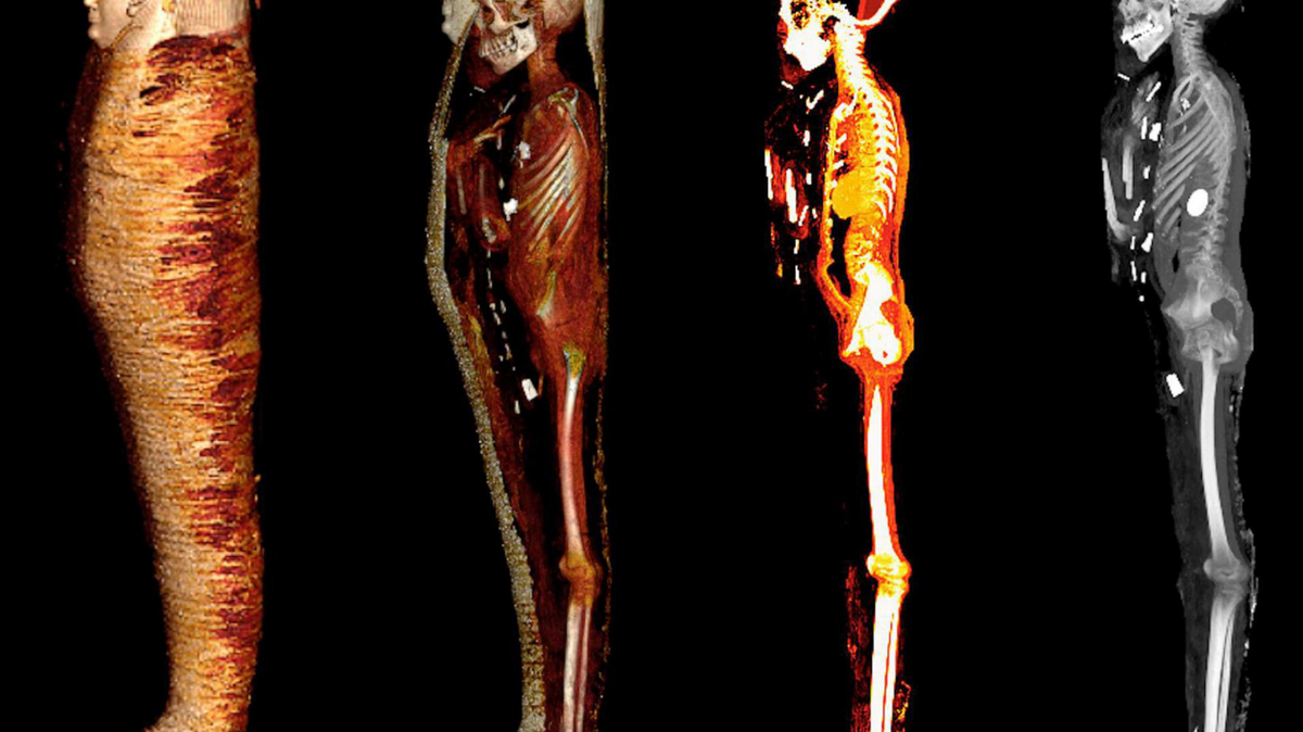 A mummy that sat in storage for over 100 years was finally examined, researchers in Cairo said. Scans revealed dozens of golden treasures.