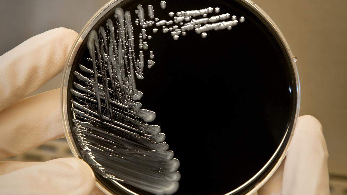Legionella pneumophila, the bacterium that can cause Legionnaires’ disease, growing on specialized microbiological media (BCYE).