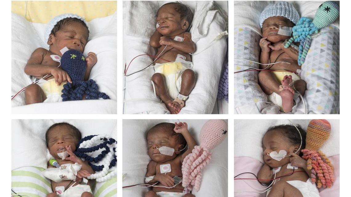 Sextuplets were delivered at 30 weeks at VCU Medical Center, the first time in the facility's history for such a large birth.
