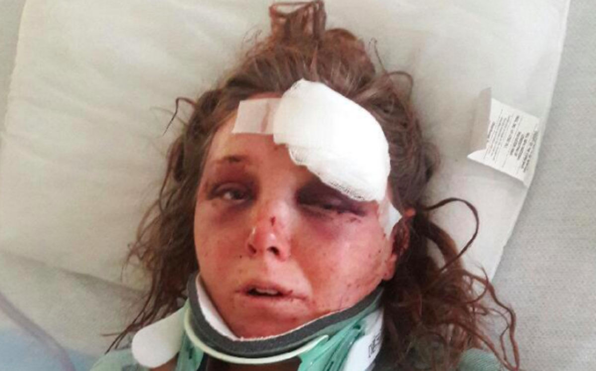 Carleigh Hager after her assault from her hospital bed.