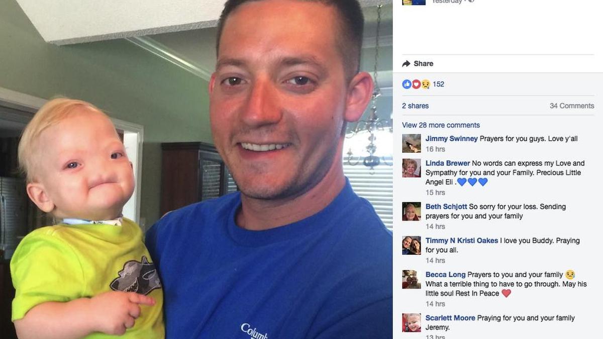 Two-year-old Eli Thompson, who made worldwide headlines when he was born without a nose, died on Saturday night. “He touched a lot of people’s lives. A lot of people cared about him,” said his father, Jeremy Finch, on Facebook.