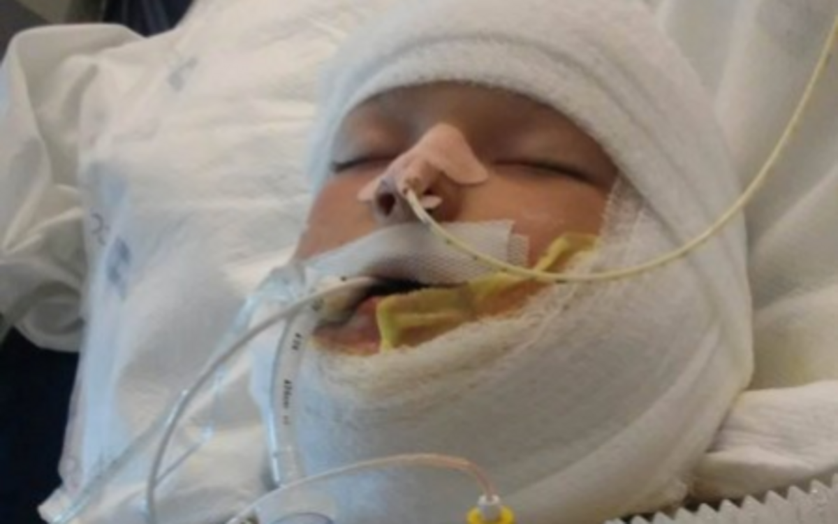 Kayden Culp has been in the hospital since Sunday, when three boys he believed were his friends led him out to a field, doused him in gasoline and set him on fire.