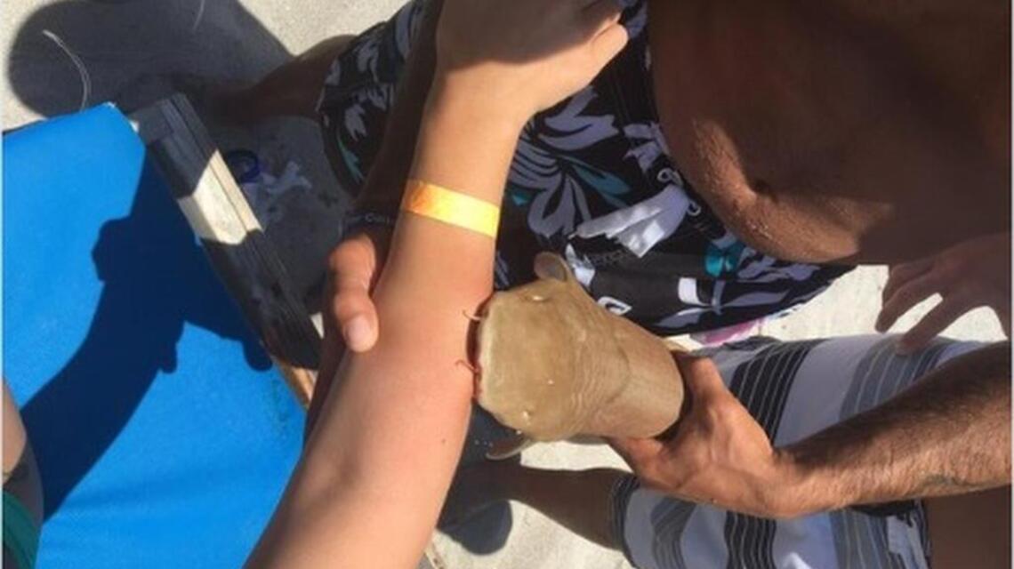 Woman taken to hospital with small shark still attached to her arm
