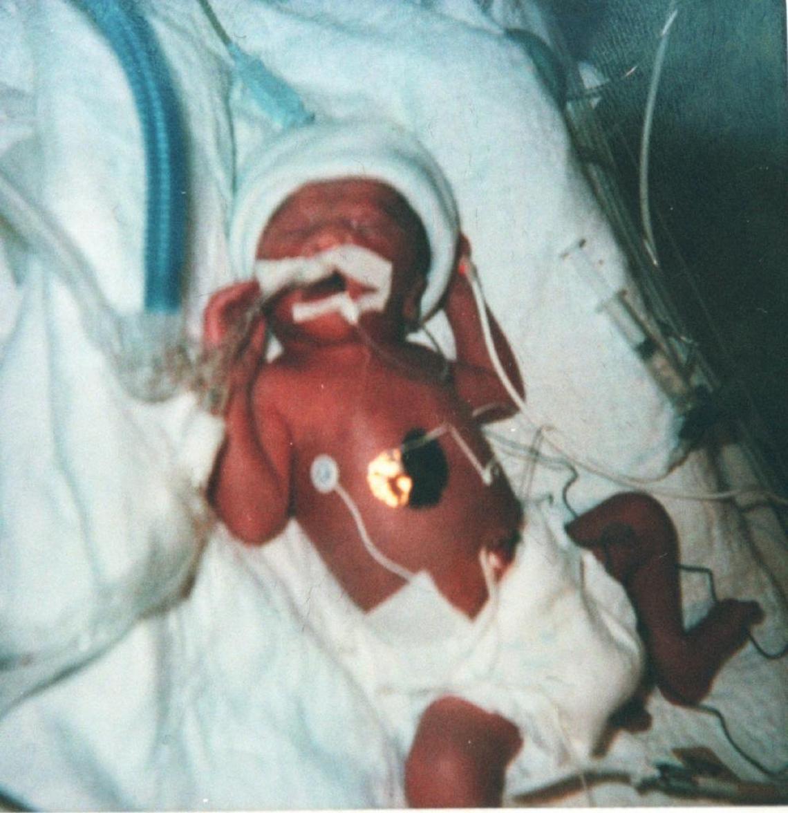 This photo of Chancellor Lee Adams shortly after he was born 10 weeks prematurely on Nov. 16, 1999, was introduced at Rae Carruth’s trial in 2000.