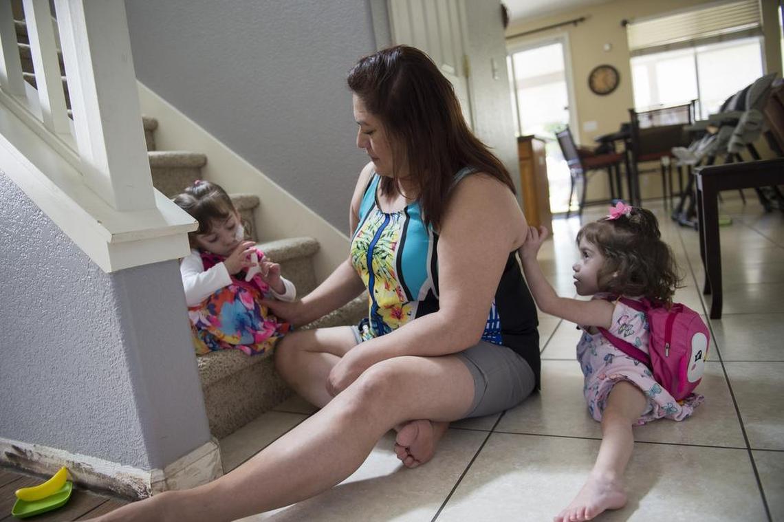 Aida Sandoval sits on the floor with twins Eva, left, and Erika, right, as Erika pulls a hair clip from her hair, Wednesday, June 14, 2017, in Antelope, Calif. The family is adjusting to life at home after many months in the hospital following their separation surgery.