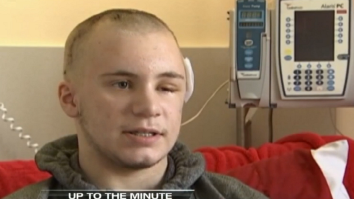 Washington teen injured in ‘duct tape challenge’