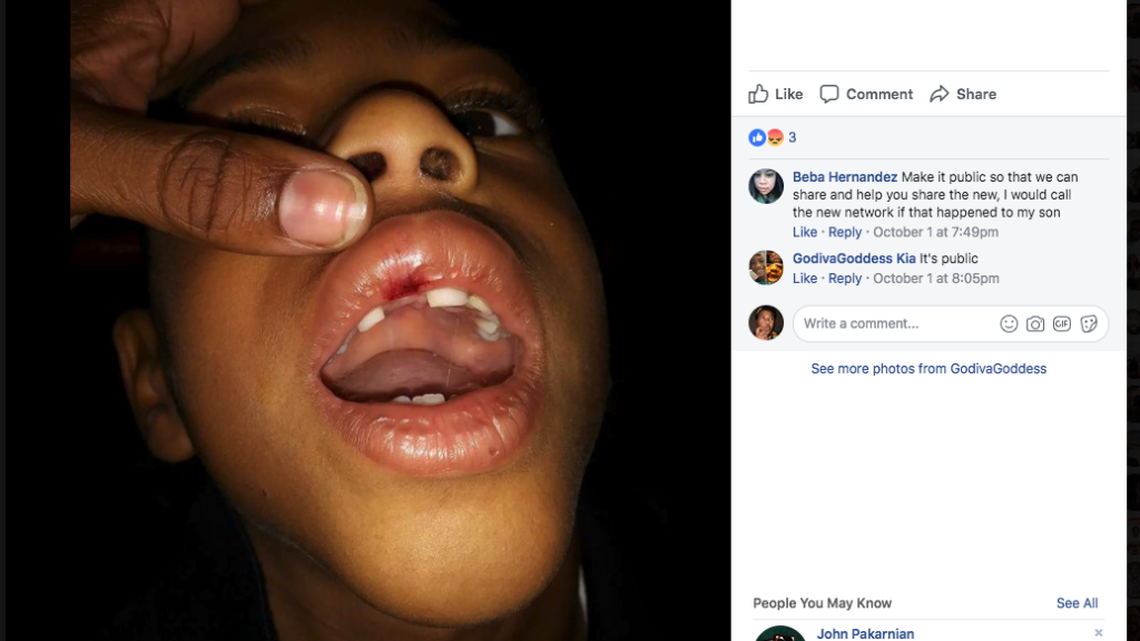 A teacher allegedly pushed Marlon K’Harii Williams, 6, so hard a tooth was knocked while another had to be removed.